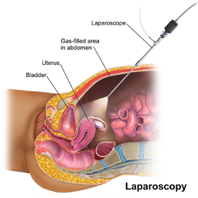 best laparoscopic surgeon in Haryana, gall bladder stone removal surgery cost in Haryana, best general surgeon in haryana, laparoscopic surgery cost in haryana, best gallbladder laparoscopic surgeon in haryana, Advanced Laparoscopic and General Surgery in haryana, Laparoscopic General Surgery in haryana, best surgeon in haryana, Top Laparoscopic surgeon haryana, Doctor for Laparoscopic General Surgery in Haryana, Laparoscopic Treatment in Haryana, Gall Bladder Removal Surgery in haryana, Laparoscopic Cholecystectomy in haryana
